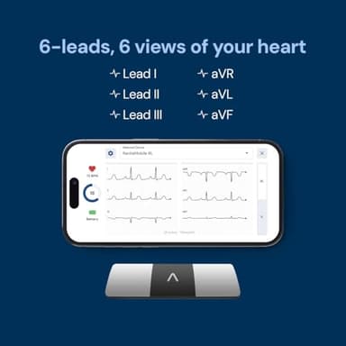 KardiaMobile 6-Lead Personal EKG Monitor – Six Views of The Heart – Detects AFib and Irregular Arrhythmias – Instant Results in 30 Seconds – Works with Most Smartphones - Image 5