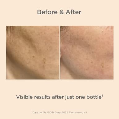 Isdinceutics Melaclear Advanced - Dark Spot Corrector for Face with Niacinamide 1.7 FL OZ (50 ml). - Image 7