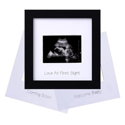 eletecpro Ultrasound Picture Frame with Real Glass Cover and 3 Different Mats, 7x7 Baby Keepsake Frame for 3x4 Inches Sonogram Photo, Wall Mount or Tabletop Display, Pregnancy Announcement, Black - Image 1