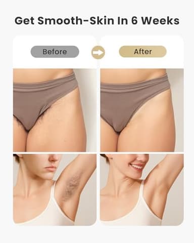 UENMOON Laser Hair Removal for Women and Men - 5.2 cm² Contact Nearly Painless, Powerful Long-Lasting IPL Hair Removal at-home, Effective in 14 Days with Ultra-fast Light Emission for Whole Body Use - Image 5