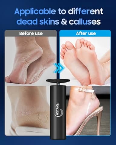 HayZBao Electric Foot File - Electric Callus Remover for Feet,Adjustable Speed Foot Scrubber with 60 Pcs Sandpaper Discs,Professional Pedicure Tool for Dead Skin and Calluses - Black - Image 5
