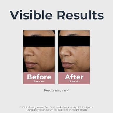 Eucerin Radiant Tone Dual Serum Dark Spot Corrector, Dark Spot Serum with Thiamidol and Hyaluronic Acid, Helps Visibly Reduce the Look of Persistent Dark Spots, 1 Fl Oz Bottle - Image 6