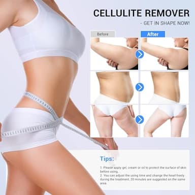 MEIQIER sens for Improvement in The Appearance of Cellulite Device Cellulite Massager Radio Frequency, White - Image 2