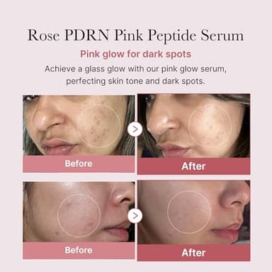medicube PDRN Pink Peptide Serum, Pink glow serum, Peptide, Niacinamide, Hydrating & Moisturizing & Firming, Uneven Skin Tone, Korean Skincare | 1.01 fl.oz. (1.01 fl.oz., Rose PDRN (Vegan)) - Image 2