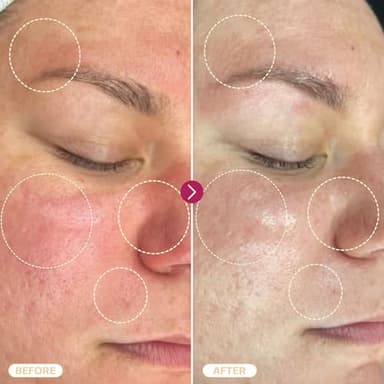 BASE LABORATORIES Hypochlorous Acid Spray for Face & Skin | 8 oz | Facial Spray Daily Skin Repair Solution for Sensitive Skin, Redness, Irritations, Eczema, Acne. Hypochlrous HOCL Molecule Spray - Image 5