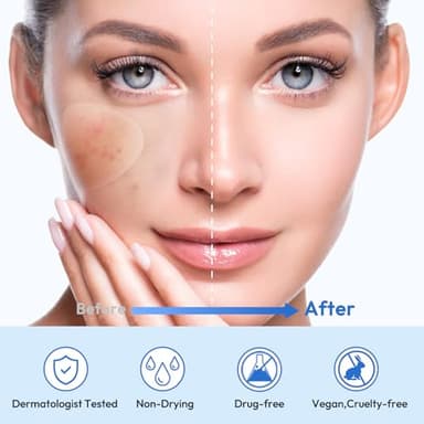 Full Face Pimple Patches(5 Pack),Big Hydrocolloid Acne Patches,Skin Care Zit Patches for Whole Face,Nose, Chin, Forehead & Cheeks w/Tea Tree Oil, Salicylic Acid & Cica Oil（5 Pack,25 Patches） - Image 5