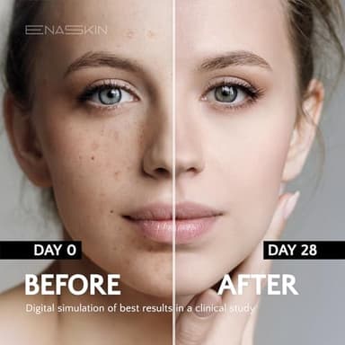EnaSkin Dark Spot Remover Face & Body Serum: Age Spot Sun Spot Freckles Melasma Brown Spot - Advanced Formula with Niacinamide for Women and Men (1.0 Fl Oz - Image 4