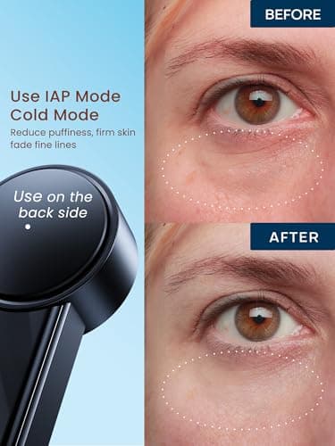 Radio Frequency Skin Tightening Device, Smart Electric Zinc Alloy Facial Beauty Machine with RF-Current Cold Heat for Jawline Lifting, Cheek Firm, Wrinkle Reduction, Depuff, Increase Absorption - Image 7