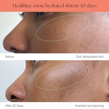 Canopy Bedside Evaporative Humidifier - 36 HR Run Time, 2.5L Capacity - No Mist - Help Alleviate Symptoms of Allergies, Flu, Cold, Dry Skin Includes Humidifier, Unwind Aroma, Filter - White - Image 8