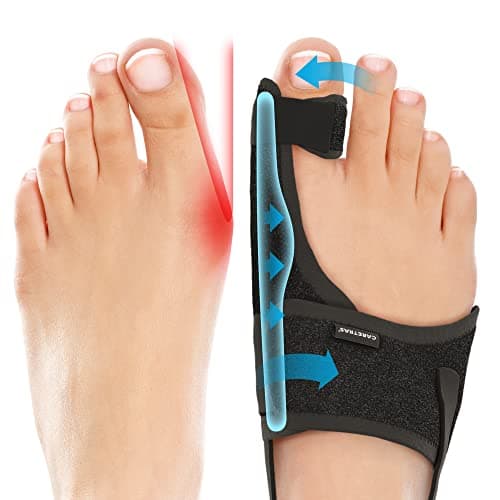 Caretras 2-Pack Bunion Corrector for Women & Men, Orthopedic Bunion Splint for Hallux Valgus Pain Relief, Big Toe Separator, Adjustable Day/Night Support, Comfortable Hammer Toe Straightener - Image 1