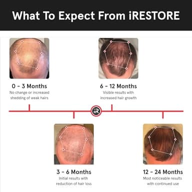 iRestore Essential - Laser Red Light Therapy for Hair Growth - FDA Cleared Hair Loss, Hair Thinning & Alopecia Treatment for Men & Women - Laser Cap for Hair Regrowth Stimulate Denser Fuller Hair - Image 5