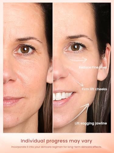Radio Frequency Skin Tightening Device, Anti-Aging Face Machine for Wrinkle Removal, Lifting & Firming, Wireless Home Beauty Device with 3 Levels, at-Home Skin Renewal - Image 3