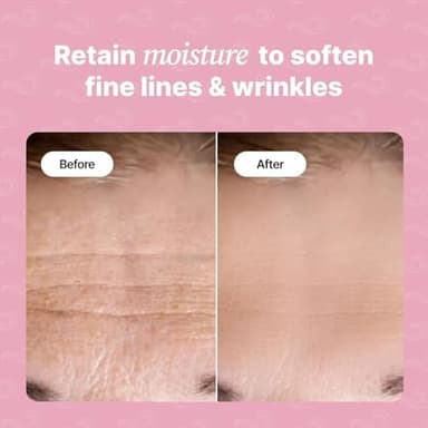 Forehead Wrinkle Patches | Anti-Wrinkle Facial Patches for Fine Lines | Overnight Wrinkle Filler & Deep Line Treatment | Disposable Face Tape for a Youthful, Firmer, and Smoother Appearance | 20 Count - Image 3