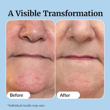 Vibriance Super C Serum for Mature Skin - All-in-One Vitamin Formula Hydrates, Firms, Lifts, Smooths, Targets Age Spots, Wrinkles, 1 fl oz - Image 5