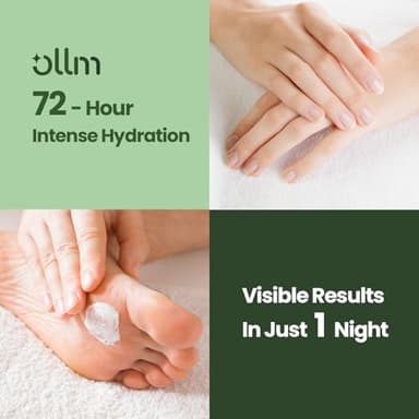 Urea Cream 40 Percent for Feet - Foot Cream for Dry Cracked Heels, 2% Salicylic Acid for Callus Remover, Maximum Strength Repair Skin, Soft & Smooth 40% Urea Lotion Moisturizer Elbows Hands Knees - Image 4