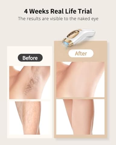 UENMOON Laser Hair Removal for Women and Men - IPL Hair Removal with Ice-Cooling System for Painless & Long-Lasting Result, Whole Body Hair Removal - Image 2