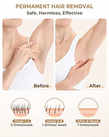 LYSMOSKI Laser Hair Removal Device for Women and Men at Home IPL Hair Removal Device for Facial Legs Arms Whole Body Use - Image 2