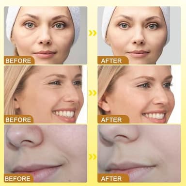 stray poet 3Pcs Botox Bee Venom Cream Wrinkle Removal & Firming,Moisturizing,Lifting & Recovery for All Skin Type,Anti-Aging Bee Venom Cream,Face Cream Moisturiser - Image 4