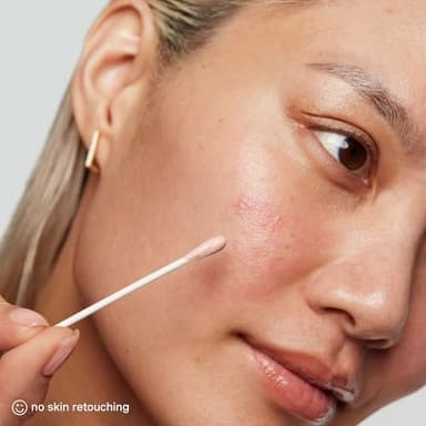 Kate Somerville EradiKate Acne Treatment - Clinically Formulated 10% Sulfur and BHA Spot Treatment – Clears Pimples, Cleans Pores and Prevents Breakouts, 1 Fl Oz - Image 7