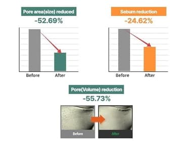 S. Nature AQUA SQUALANE MOISTURIZING CREAM | Face Moisturizer for Dry and Sensitive Skin, Vegetable Squalane 150,00ppm, Long-lasting Hydration, Pore Care Cream, Korean Skin Care (2.02 Fl Oz, 60ml) - Image 5