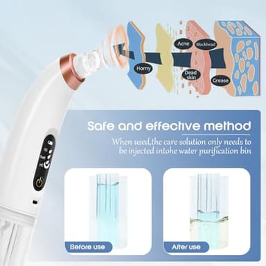 Danvisit Blackhead Remover Vacuum: Water Cycle Facial Pore Cleaner with 3 Suction Power 6 Probes USB Rechargeable Pore Vacuum Blackhead Extractor Tools - Image 6