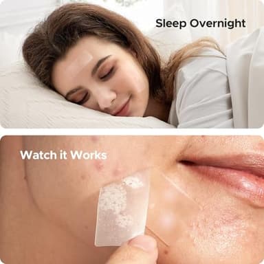 TKTK Large Pimple Patches, 60 mm XL Acne Patches, Big Hydrocolloid Bandages for Body, Face, Forehead, Chin, Neck Zit Breakouts, Hydrocolloid Patch (Square, Strip, Dot 5 Sizes 62 Count) - Image 7