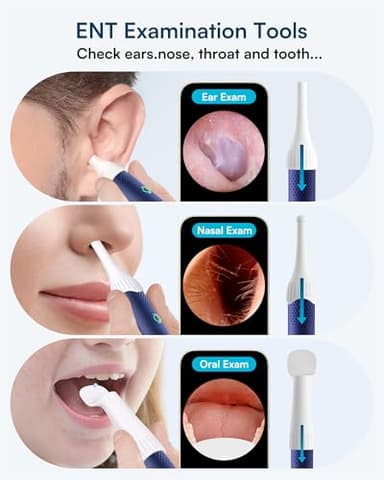BEBIRD Flexible Ear Wax Removal Tool Camera, FSA HSA Eligible Items, Wireless Smart Visual Ear Cleaning Kit with 13-Piece Tips, HD Camera Ear Otoscope with Tweezers, Earsight Plus B31R Earwax Cleaner - Image 6