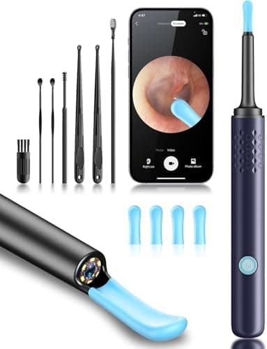 Ear Wax Removal Tool Camera - Ear Cleaner with Camera,1080P Otoscope, Ear Cleaning Tool with 4 Ear Spoon, Ear Camera for iPhone & Android Phones - Blue - Image 1