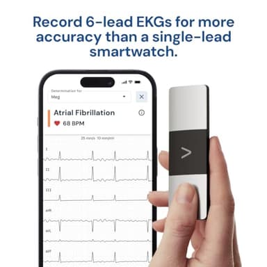 KardiaMobile 6-Lead Personal EKG Monitor – Six Views of The Heart – Detects AFib and Irregular Arrhythmias – Instant Results in 30 Seconds – Works with Most Smartphones - Image 3