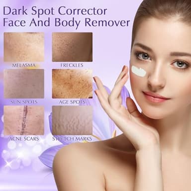 YRNVK Dark Spot Remover for Face Cream, Dark Spot Corrector, Rapid Tone Repair Retinol Serum for Sun Spots, Age Spots, Skin Brown, Melasma Skin Care with Upgraded Formula Vitamin C for Women 1.7 Fl OZ - Image 2