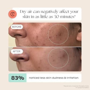 Canopy Bedside Humidifier 2.0, White, 36 HR Run Time, 2.5L Capacity - Reading Light & White Noise - Alleviate Symptoms of Allergies, Flu, Cold, Dry Skin - Humidifier, Filter, Power Cord & Adapter - Image 7