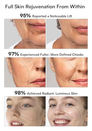 INIA 3-in-1 Red Light Therapy for Face and Neck, Skin Tightening Device True Beauty Glow Facial Massager for Skin Care, Effective Wrinkle Reduction Anti-Aging with Lifting, Tightening, Infusing - Image 3