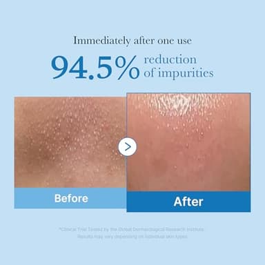 medicube Smooth Pore Double Cleanse Set: Zero Pore Blackhead Cleansing Oil and Zero Pore Clear Blue Capsule Facial Cleanser - Image 2