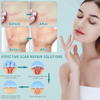 Pumkot Advanced Scar Cream, Silicone Gel for Scars, Professional Scar Removal Cream for Surgical Scars, Stretch Marks, Old and New Scars 1.7 oz(50ml) - Image 4