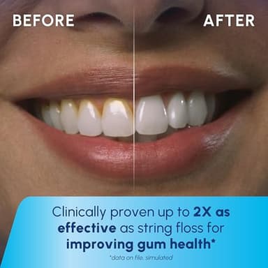 Waterpik Cordless Pulse Rechargeable Portable Water Flosser for Teeth, Gums, Braces Care and Travel with 2 Flossing Tips, Waterproof, ADA Accepted, WF-20 Blue, Packaging May Vary - Image 5