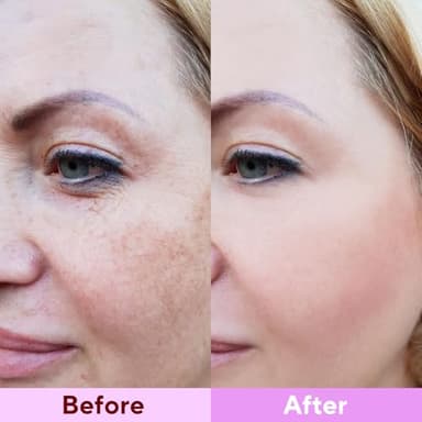 Nityrliv Bio-Collagen Real Deep Mask, 4 Pack Overnight Hydrating Face Mask for All Skin Types,Original Hydrating Collagen Face Mask - Image 7