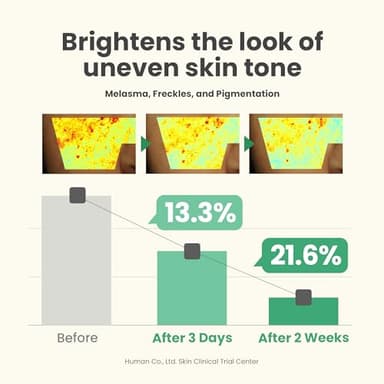 AXIS-Y Dark Spot Correcting Glow Serum - 5% Niacinamide Dark Spot Remover For Face - Vegan Korean Skin Care Niacinamide Serum for All Skin Types - 1.69 fl. oz. - Image 6