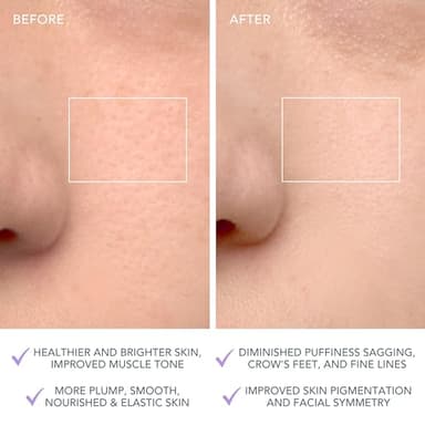 FOREO LUNA 4 Face Cleansing Brush - Firming Face Massager - Anti Aging Care - Enhances Absorption - Simple Skin Care Tools - Sensitive Skin - Image 5