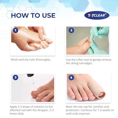 Ingrown Toenail Relief: Ingrown Toenail Tool for Men Women - Ingrown Toenail Removal Kit - Ingrown Toenail Corrector Drops - Ingrown Toenail Removal - Effective Solution for Ingrown Toenails - 30ml - Image 5