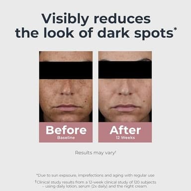 Eucerin Radiant Tone Dual Serum Dark Spot Corrector, Dark Spot Serum with Thiamidol and Hyaluronic Acid, Helps Visibly Reduce the Look of Persistent Dark Spots, 1 Fl Oz Bottle - Image 4