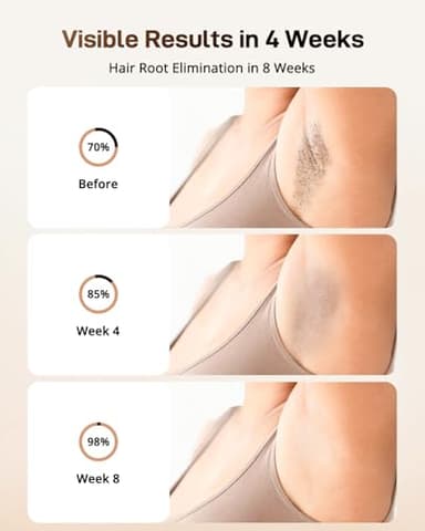 LYSMOSKI Laser Hair Removal with Cooling System, IPL Hair Removal for Women and Men, 3-in-1 At-Home Hair Removal Device for Facial Legs Arms Whole Body Use, 9 Energy Levels - Image 3