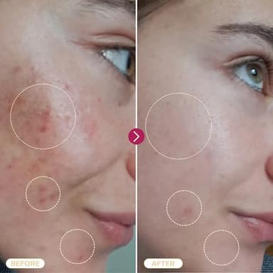 BASE LABORATORIES Hypochlorous Acid Spray for Face & Skin | 8 oz | Facial Spray Daily Skin Repair Solution for Sensitive Skin, Redness, Irritations, Eczema, Acne. Hypochlrous HOCL Molecule Spray - Image 7
