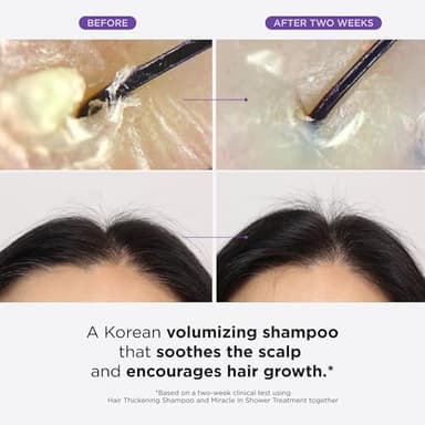 Dr. Groot Hair Thickening Shampoo, Korean Hair Care with Biotin, Rosemary Oil to Help Volumize Thinning, Damaged Hair, Hydrate Hair and Scalp, Biotin Shampoo, Scalp Revitalizing Solution - Image 7