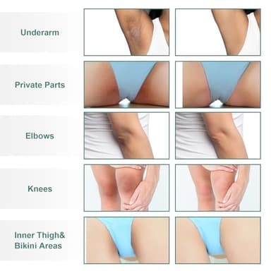 Vcetree Skin Bleaching Cream Skin Lightening for Body Intimate Areas, Private Parts, Underarm, Knees, Elbows, Inner Thigh, Bikini Area, Whitening Cream Dark Spot Remover For Intimate Areas (1FL OZ) - Image 3