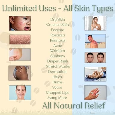 Beef Tallow for Skin | NAKED TALLOW BALM | 1 Ingredient - 100% Grass Fed Beef Tallow | Beef Tallow for Body & Face | Whipped & UNSCENTED for Sensititve Dry Skin, Babies, Eczema, Psoriasis, Rosacea (4oz) - Image 6