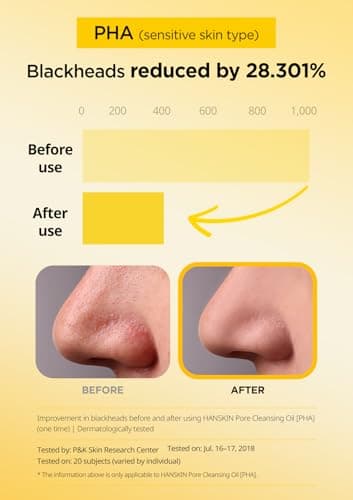 Hanskin Pore Cleansing Oil, Oil Cleanser for Face, Makeup Blackhead Sebum Remover, Korean Deep Pore Cleanser for Sensitive Skin [PHA] (10.14 oz) - Image 3