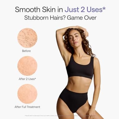 Ulike Laser Hair Removal Device Air 10 Ipl Gift for Women and Men, Ice Cool and Permanent Hair Reduction for Nearly Painless, Dual Lights, Skin Sensor & USHR Mode Hair Removal in 10mins from Home - Image 6