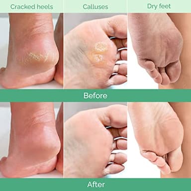 PLANTIFIQUE Foot Peeling Mask 4 Pack | Dermatologically Tested Repairs Heels & Removes Dry Dead Skin for Baby Soft Feet | Exfoliating Foot Peel Mask for Dry Cracked Feet - Image 3