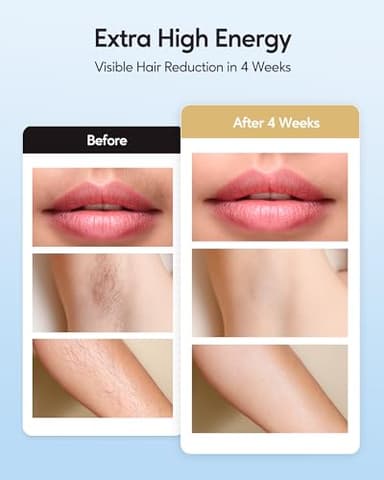 INNZA IPL Hair Removal with Ice Cooling Care Function for Women Permanent,999,999 Flashes Painless IPL Hair Remover, Hair Removal Device for Armpits Legs Arms Bikini Line - Image 3