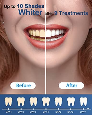 MySmile Teeth Whitening Gel Pen Refill Pack, 3 Non-Sensitive Teeth Whitening Pen, Deluxe Teeth Whitener Dental Grade Tooth Whitening Gel with Carbamide Peroxide for Home, 10 min Fast Result - Image 6